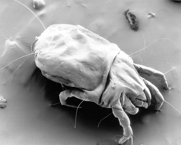 ダニの一例：ヤケヒョウヒダニ（Dermatophagoides pteronyssinus）の雌を写した走査電子顕微鏡写真